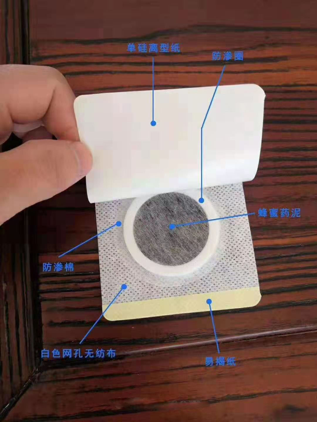 穴位壓力刺激貼。